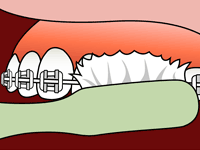 brushing diagram